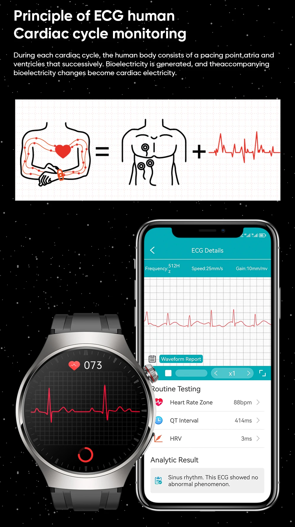 Xiaomi Mijia-reloj inteligente ECG + PPG para hombre y mujer, pulsera con llamadas, Bluetooth, control del ritmo cardíaco y de la salud, Pantalla AMOLED HD, control del azúcar en sangre